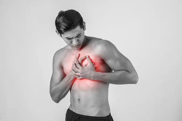 Understanding Intercostal Neuralgia