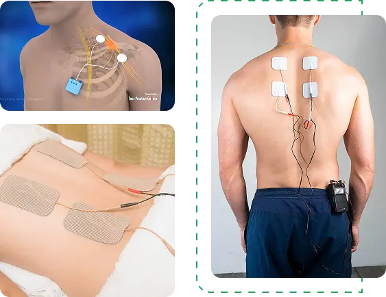pns trial