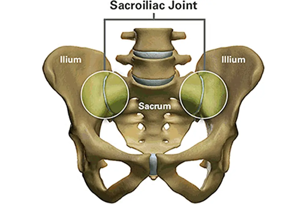 What Is the SI Joint and Why Does It Matter